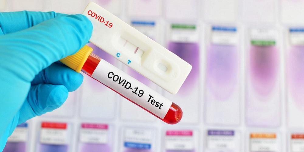 Bagaimana Ujian Pantas Digunakan untuk Mengesan COVID-19