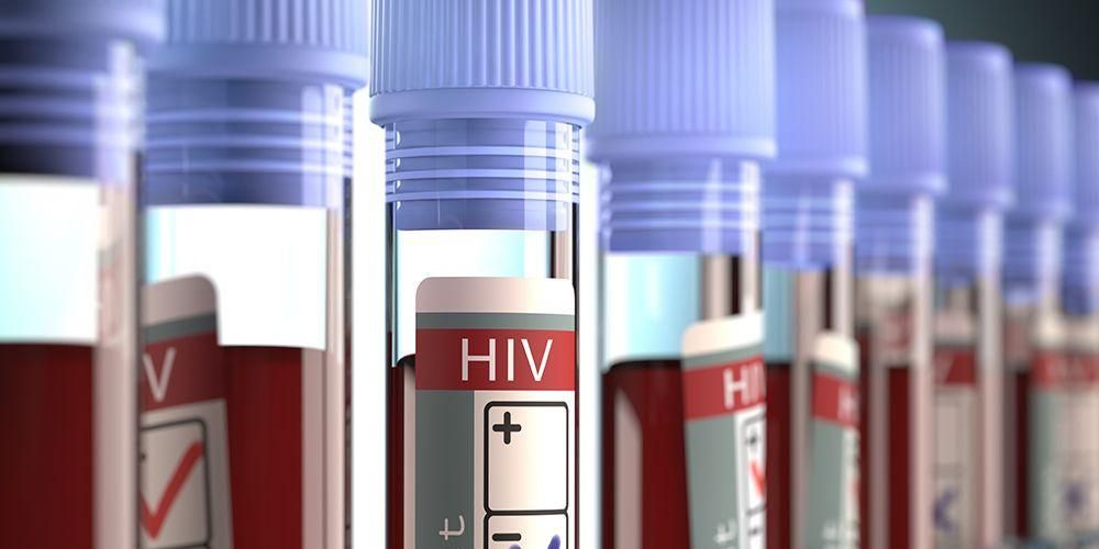 HIVと発生する可能性のある感染症の症状を治療する方法