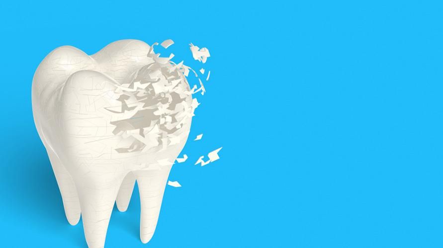 Чупливи и счупени зъби? Може да са признаци на несъвършенство на дентиногенезата
