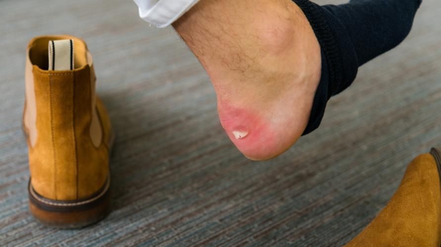 靴の足の傷を防ぐ5つの方法
