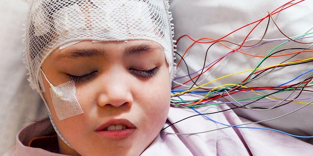 Epilepsinin Çocuk Gelişimine Etkisi Nedir?