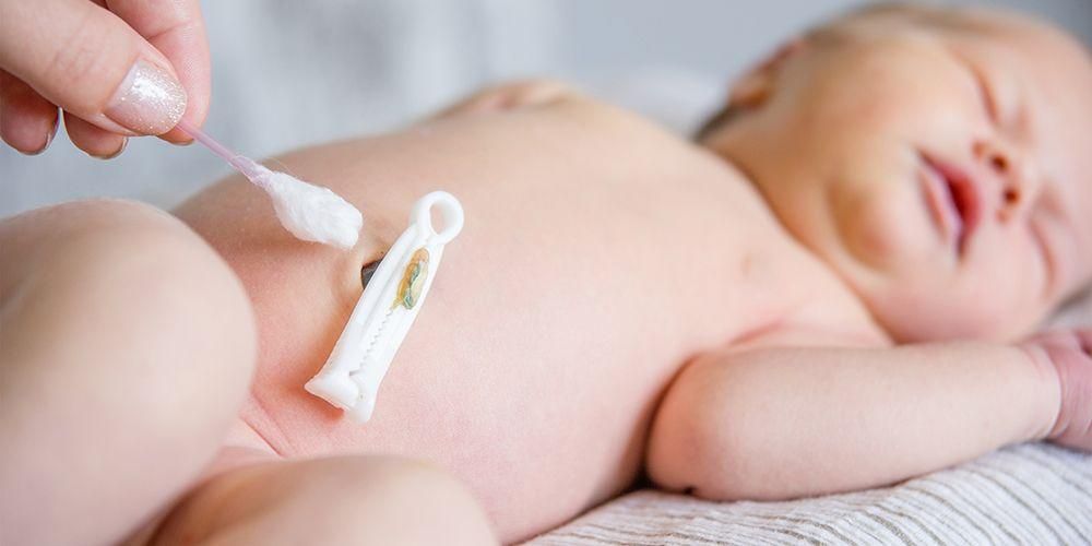 Hernia pada Bayi, Kenali Punca dan Cara Mengubatinya