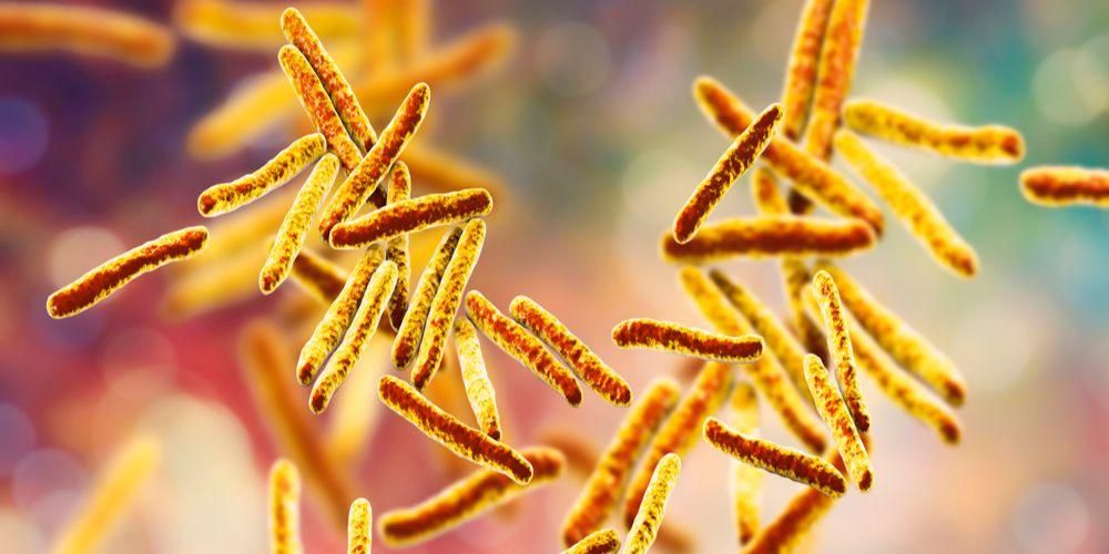 Mengenal tuberkulosis kulit, penyakit jarang yang gejalanya sukar dikenali