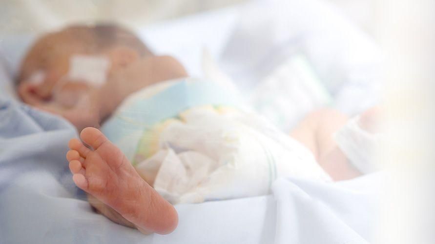 新生児におけるTTN（新生児の一過性頻呼吸）：原因、症状、および治療