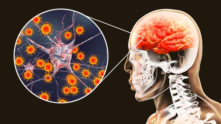 Beyin Enfeksiyonu Türleri ve Dikkat Edilmesi Gereken Belirtiler