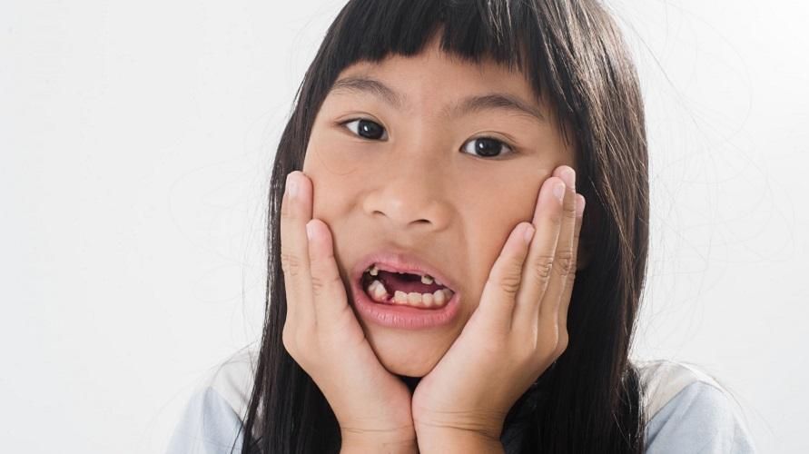สาเหตุของฟันหักและวิธีดูแลฟันที่พ่อแม่ควรรู้