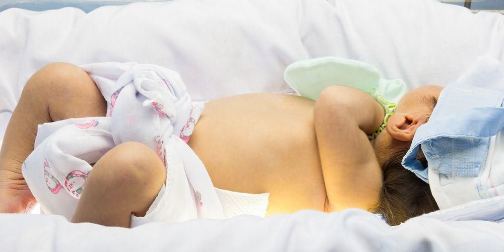 Внимавайте, високият билирубин при бебетата може да причини тези опасни усложнения