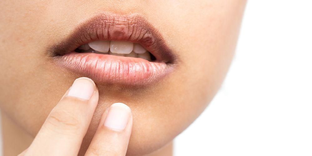 Разпознайте 6 причини за сухота в устата и как да я преодолеете