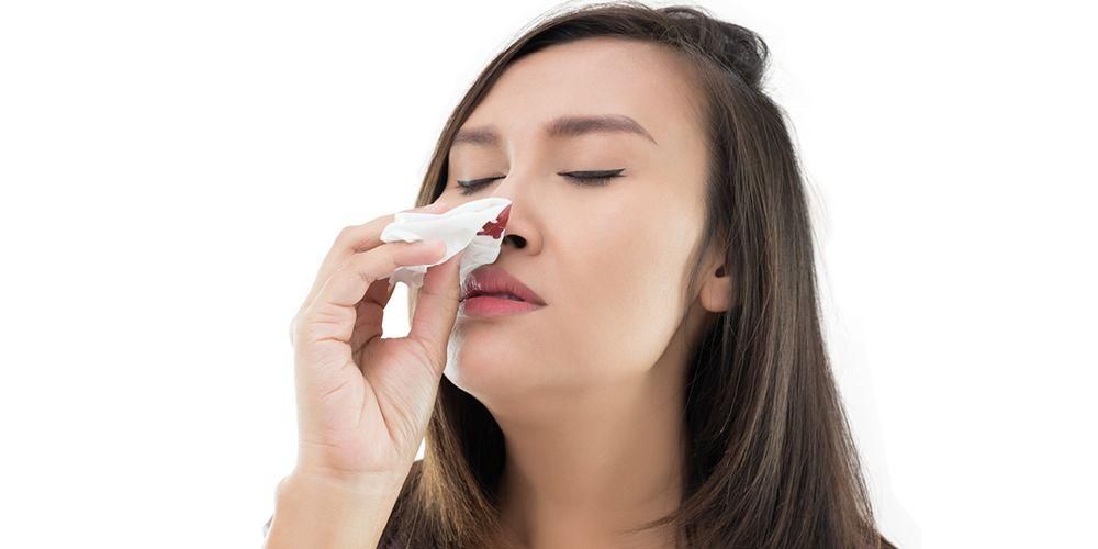 Riconoscere le cause del sangue dal naso negli adulti