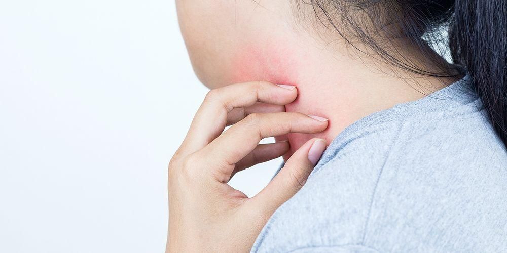 Mengenal Pelbagai Ujian Alergi Yang Dapat Mengesan Pencetus Alergi