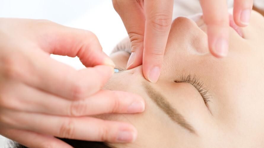 Baş ağrısı için akupunktur noktalarını ve faydalarını öğrenin