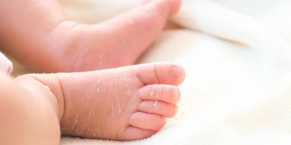 赤ちゃんの皮膚の剥離、これらの原因とそれを克服する方法