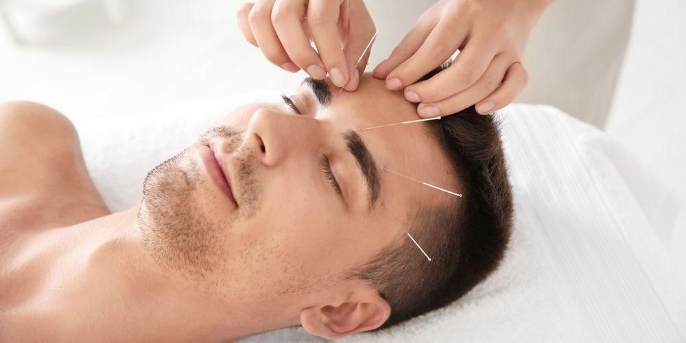 Semua Yang Anda Perlu Tahu Mengenai Akupunktur Muka