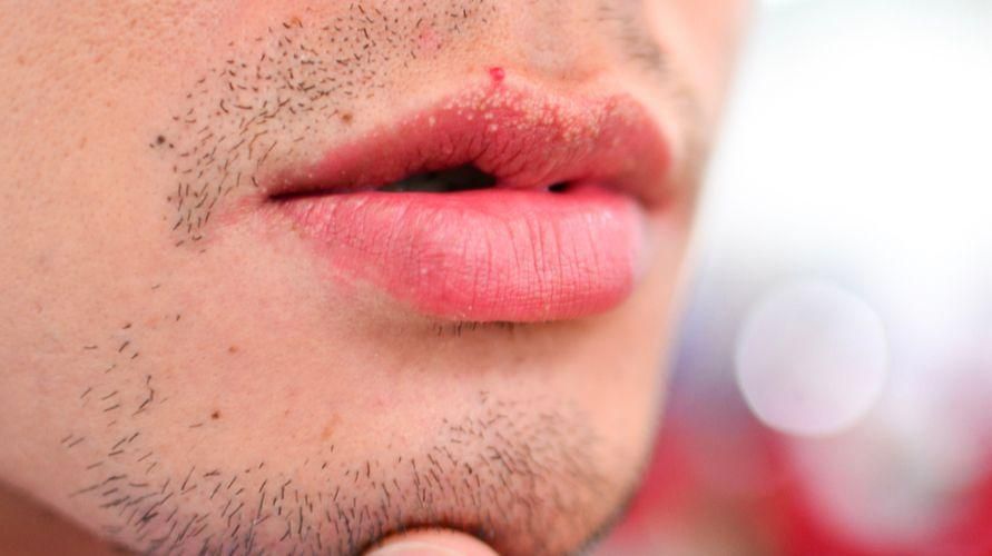10 причини за изтръпване на устните, които не бива да подценявате