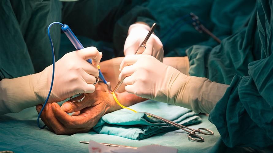 Преодоляване на фистула артериовенос с хирургия на Cimino, как да го направя?