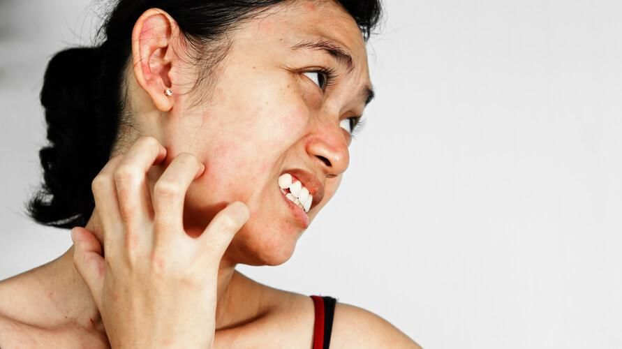 L'eczema sul viso interferisce con l'aspetto, sappi come affrontarlo