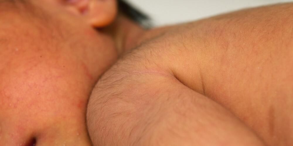 Menumbuhkan Rambut Halus (Lanugo) di Seluruh Badan Bayi, Adakah Biasa?