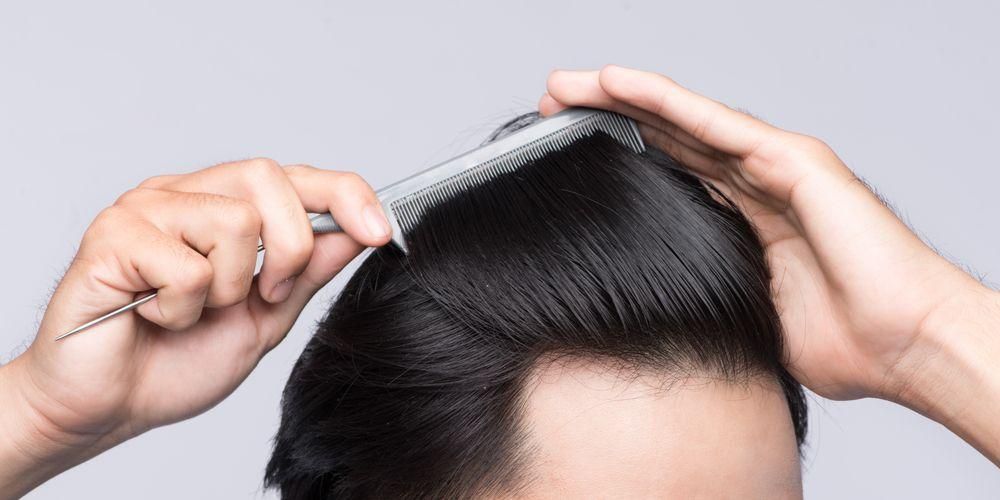 Комбинация от подхранване на косата за мъже и витамини за предотвратяване на плешивост