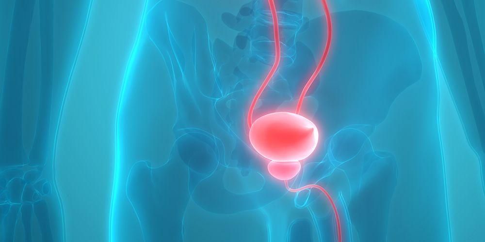 Infiammazione della prostata: tipi, cause e sintomi da notare