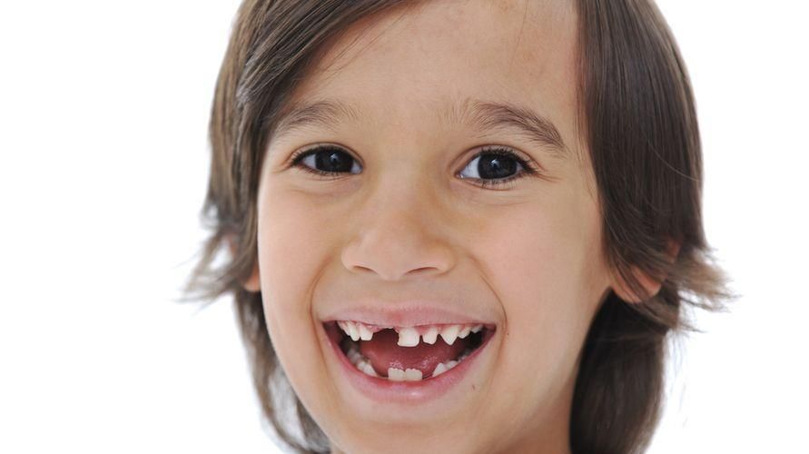 Attenzione all'ipodonzia se i denti non crescono ancora