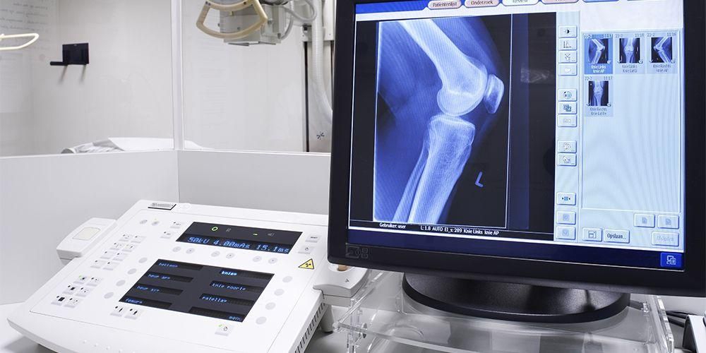 Semua yang Anda Perlu Tahu Mengenai Kehilangan Lutut