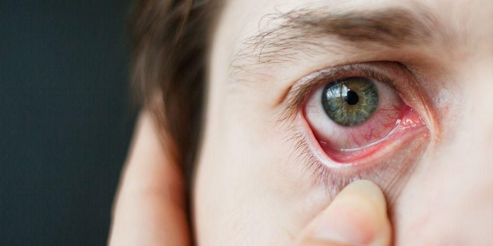 Penyakit Mata kerana Diabetes yang Menyebabkan Penglihatan Buram dan Komplikasi Lain