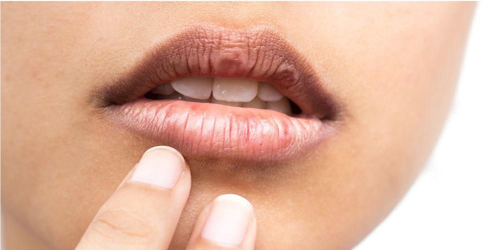 8 วิธีง่ายๆ ในการเอาชนะริมฝีปากแห้งขณะถือศีลอด