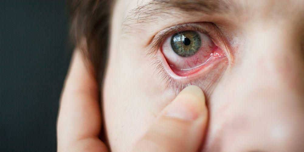 วิตามินสำหรับดวงตาที่มีประโยชน์ต่อการรักษาสุขภาพ