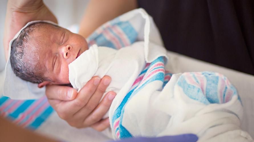 Открито от новородено, какво е фокомелия при бебета?