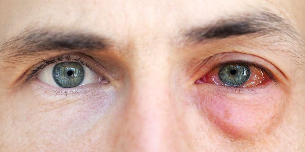 目の怪我のさまざまな原因とそれを克服する方法