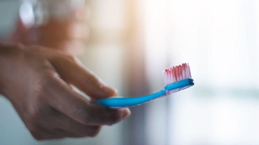歯磨き時の歯茎の出血の原因とその治療法